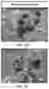 Fig. 37 - USE OF OVARIAN-DERIVED HYDROGELS FOR RESTORATION OF REPRODUCTIVE FUNCTION AND HEALTH IN WOMEN