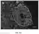 Fig. 40 - USE OF OVARIAN-DERIVED HYDROGELS FOR RESTORATION OF REPRODUCTIVE FUNCTION AND HEALTH IN WOMEN