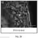 Fig. 41 - USE OF OVARIAN-DERIVED HYDROGELS FOR RESTORATION OF REPRODUCTIVE FUNCTION AND HEALTH IN WOMEN