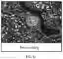 Fig. 42 - USE OF OVARIAN-DERIVED HYDROGELS FOR RESTORATION OF REPRODUCTIVE FUNCTION AND HEALTH IN WOMEN