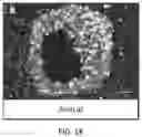 Fig. 44 - USE OF OVARIAN-DERIVED HYDROGELS FOR RESTORATION OF REPRODUCTIVE FUNCTION AND HEALTH IN WOMEN