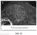 Fig. 45 - USE OF OVARIAN-DERIVED HYDROGELS FOR RESTORATION OF REPRODUCTIVE FUNCTION AND HEALTH IN WOMEN