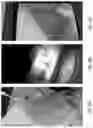 Fig. 46 - USE OF OVARIAN-DERIVED HYDROGELS FOR RESTORATION OF REPRODUCTIVE FUNCTION AND HEALTH IN WOMEN