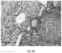 Fig. 49 - USE OF OVARIAN-DERIVED HYDROGELS FOR RESTORATION OF REPRODUCTIVE FUNCTION AND HEALTH IN WOMEN
