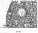 Fig. 50 - USE OF OVARIAN-DERIVED HYDROGELS FOR RESTORATION OF REPRODUCTIVE FUNCTION AND HEALTH IN WOMEN