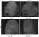 Fig. 52 - USE OF OVARIAN-DERIVED HYDROGELS FOR RESTORATION OF REPRODUCTIVE FUNCTION AND HEALTH IN WOMEN