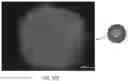 Fig. 54 - USE OF OVARIAN-DERIVED HYDROGELS FOR RESTORATION OF REPRODUCTIVE FUNCTION AND HEALTH IN WOMEN