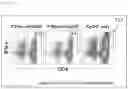 Fig. 23 - ANTIBACTERIAL COMPOSITION AGAINST DRUG-RESISTANT BACTERIA OR PRO-INFLAMMATORY BACTERIA