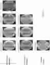 Fig. 02 - PROBIOTIC COMPOSITIONS COMPRISING LACTOBACILLUS REUTERI STRAINS AND METHODS OF USE