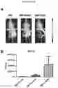Fig. 18 - Platform Oncolytic Vector for Systemic Delivery