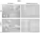 Fig. 08 - Methods of use of soluble CD24 for treating lupus nephritis