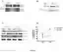 Fig. 04 - A METHOD OF IMMUNE MODULATION BY MODULATING ABCF1