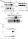 Fig. 14 - A METHOD OF IMMUNE MODULATION BY MODULATING ABCF1