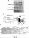 Fig. 07 - METHOD FOR TREATING COLORECTAL CANCER