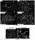 Fig. 10 - Compositions and Methods for Preventing the Interaction Between SARS-COV-2 and L-Sign