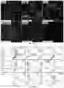 Fig. 18 - Compositions and Methods for Preventing the Interaction Between SARS-COV-2 and L-Sign