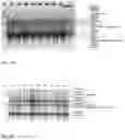Fig. 15 - Method for preparing a bone protein preparation and a bone protein preparation