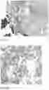 Fig. 17 - Method for preparing a bone protein preparation and a bone protein preparation