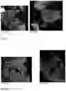 Fig. 22 - Method for preparing a bone protein preparation and a bone protein preparation