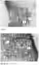 Fig. 27 - Method for preparing a bone protein preparation and a bone protein preparation