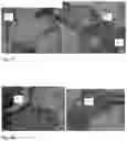 Fig. 32 - Method for preparing a bone protein preparation and a bone protein preparation