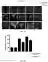 Fig. 07 - METHODS AND COMPOSITIONS FOR TREATMENT OF CANCER