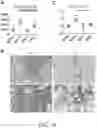 Fig. 16 - METHOD FOR TREATING AND/OR PREVENTING REGNASE-1-RELATED DISEASE