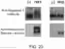 Fig. 44 - METHOD FOR TREATING AND/OR PREVENTING REGNASE-1-RELATED DISEASE