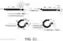 Fig. 47 - METHOD FOR TREATING AND/OR PREVENTING REGNASE-1-RELATED DISEASE