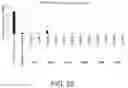 Fig. 55 - METHOD FOR TREATING AND/OR PREVENTING REGNASE-1-RELATED DISEASE