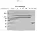 Fig. 04 - Compositions and methods for treatment of homocystinuria