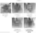 Fig. 22 - Compositions and methods for treatment of homocystinuria