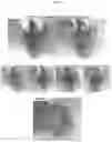Fig. 23 - Compositions and methods for treatment of homocystinuria