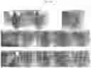 Fig. 25 - Compositions and methods for treatment of homocystinuria