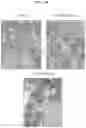 Fig. 30 - Compositions and methods for treatment of homocystinuria