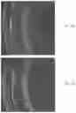 Fig. 44 - Compositions and methods for treatment of homocystinuria