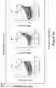 Fig. 86 - MESOTHELIN CARS AND USES THEREOF