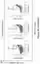 Fig. 87 - MESOTHELIN CARS AND USES THEREOF