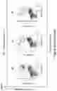 Fig. 93 - MESOTHELIN CARS AND USES THEREOF