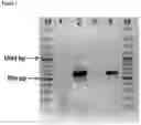 Fig. 02 - Paramyxovirus and uses thereof