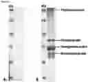 Fig. 10 - Paramyxovirus and uses thereof