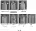 Fig. 06 - COMPOSITION FOR PREVENTING OR TREATING ATOPIC DERMATITIS COMPRISING SKIN-PENETRATING NUCLEIC ACID  COMPLEX AS EFFECTIVE COMPONENT