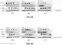 Fig. 12 - COMPOSITION FOR PREVENTING OR TREATING ATOPIC DERMATITIS COMPRISING SKIN-PENETRATING NUCLEIC ACID  COMPLEX AS EFFECTIVE COMPONENT