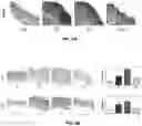 Fig. 16 - COMPOSITION FOR PREVENTING OR TREATING ATOPIC DERMATITIS COMPRISING SKIN-PENETRATING NUCLEIC ACID  COMPLEX AS EFFECTIVE COMPONENT