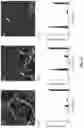 Fig. 12 - COMPOSITIONS AND METHODS FOR DISASSEMBLING AMYLOID FIBRILS