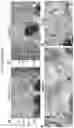 Fig. 18 - COMPOSITIONS AND METHODS FOR THE DIAGNOSIS AND TREATMENT OF RETINOPATHIES