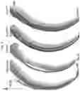 Fig. 20 - COMPOSITIONS AND METHODS FOR THE DIAGNOSIS AND TREATMENT OF RETINOPATHIES