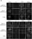 Fig. 01 - AAV GENE THERAPY FOR TREATING NEPHROTIC SYNDROME