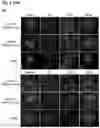 Fig. 04 - AAV GENE THERAPY FOR TREATING NEPHROTIC SYNDROME