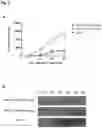 Fig. 05 - AAV GENE THERAPY FOR TREATING NEPHROTIC SYNDROME